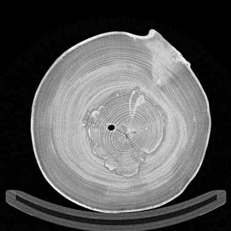 �lgesztes b�kk keresztmetszeti CT felv�tele